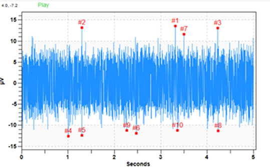 Healthy coupling time waveform